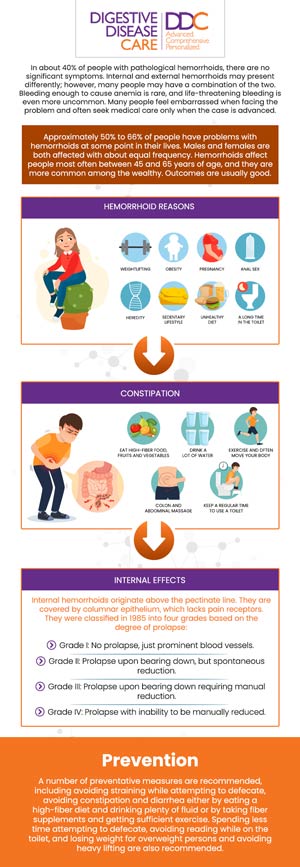 Hemorrhoids are swollen veins in the lower rectum and anus, similar to varicose veins. They are categorized as internal, often painless but prone to bleeding, and external, which can cause pain, swelling, and itching. Common triggers include chronic constipation, straining, and prolonged sitting. The team at Digestive Disease Care provides advanced, minimally invasive treatments to manage symptoms and offer lasting relief. For more information, contact us today or schedule an appointment online. We are conveniently located at 373 W Main St, Babylon, NY 11702. Hemorrhoids are swollen veins in the lower rectum and anus, similar to varicose veins. They are categorized as internal, often painless but prone to bleeding, and external, which can cause pain, swelling, and itching. Common triggers include chronic constipation, straining, and prolonged sitting. The team at Digestive Disease Care provides advanced, minimally invasive treatments to manage symptoms and offer lasting relief. For more information, contact us today or schedule an appointment online. We are conveniently located at 373 W Main St, Babylon, NY 11702.